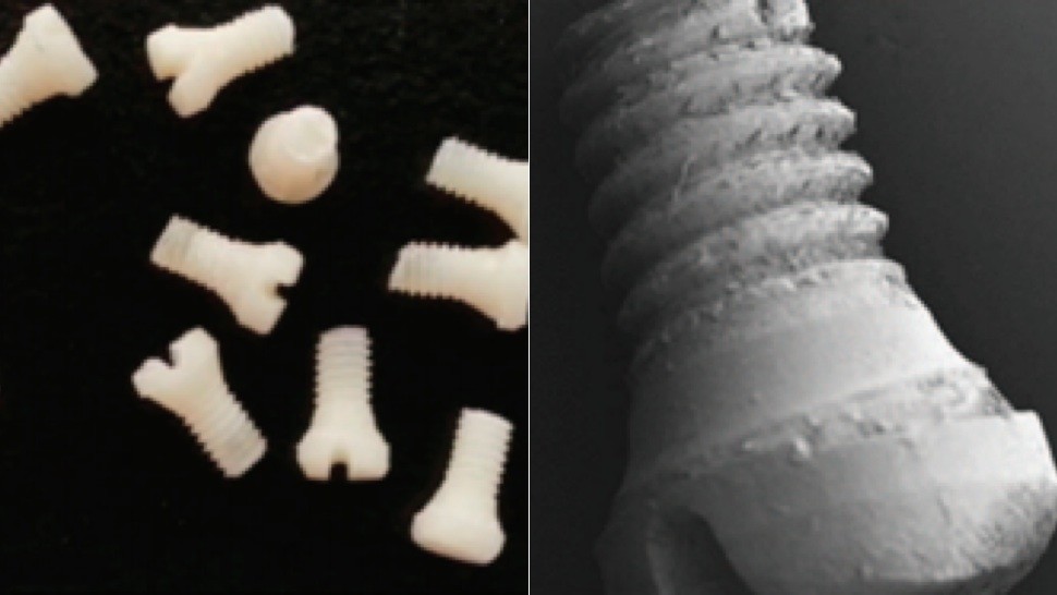 Screws made of baked silk for pinning broken bones